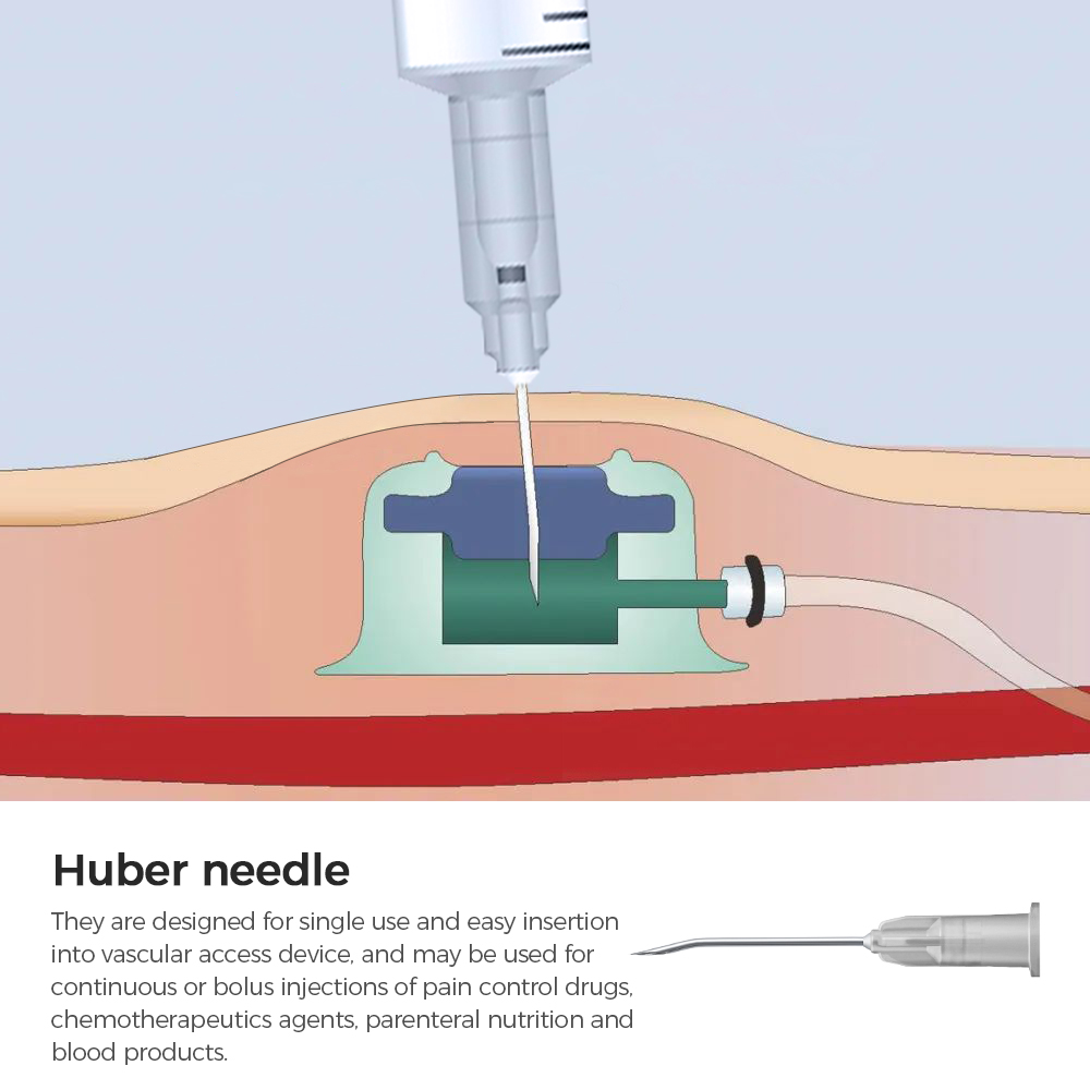Needle for Implantable Drug –supplying Device (special injection needle ...