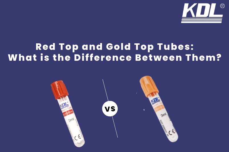 Red Top and Gold Top Tubes_ What is the Difference Between Them Red Top and Gold Top Tubes : What is the Difference Between Them