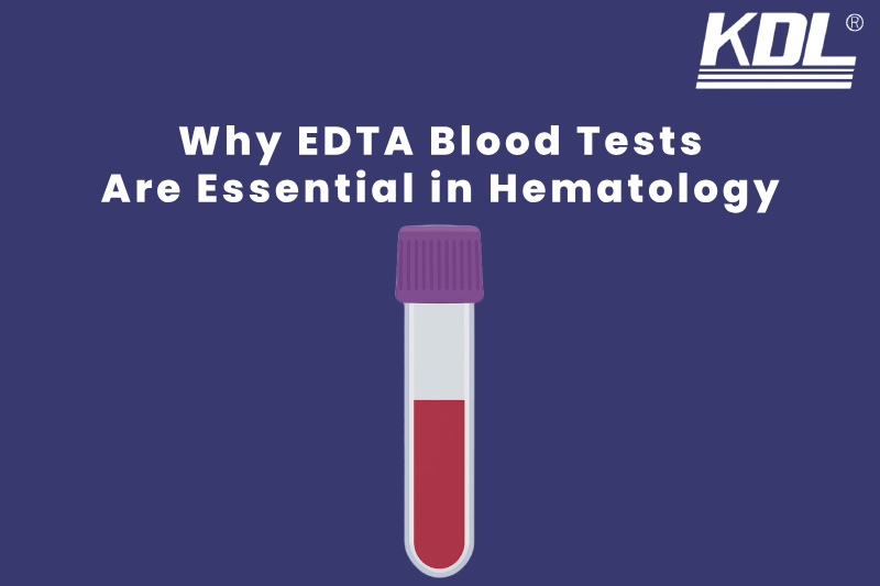 Why EDTA Blood Tests Are Essential in Hematology Why EDTA Blood Tests Are Essential in Hematology