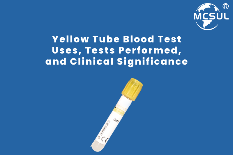 Yellow Tube Blood Test_ Uses, Tests Performed, and Clinical Significance