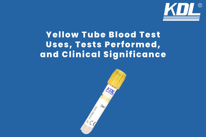 Yellow Tube Blood Test: Uses, Tests Performed, and Clinical Significance